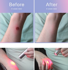 Red Light Therapy Flashlight